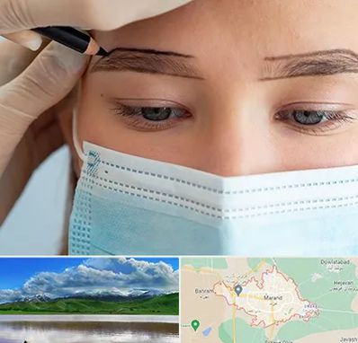 کاشت ابرو در مرند
