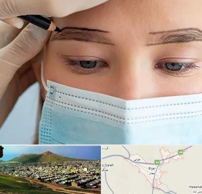 کاشت ابرو در بیجار