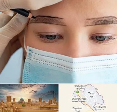 کاشت ابرو در یزد
