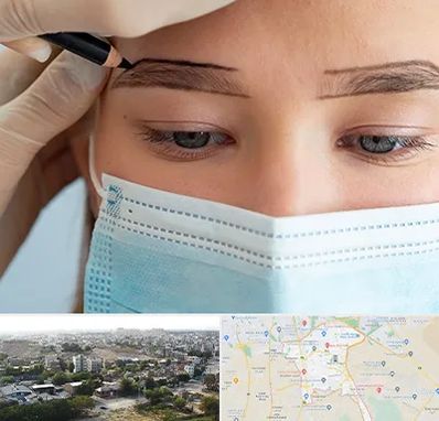 کاشت ابرو در منطقه 20 تهران 