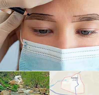 کاشت ابرو در کردان