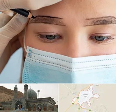 کاشت ابرو در شهرضا