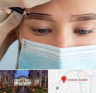 کاشت ابرو در باغ فردوس
