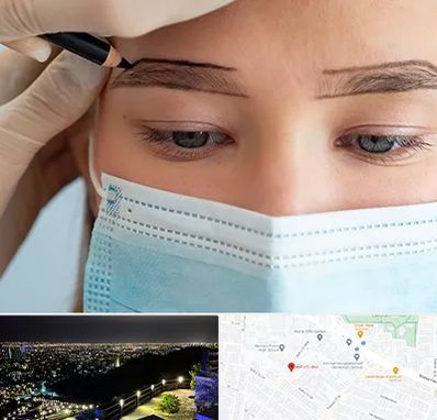 کاشت ابرو در هفت تیر مشهد 