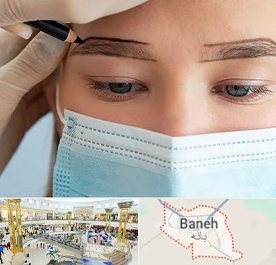 کاشت ابرو در بانه