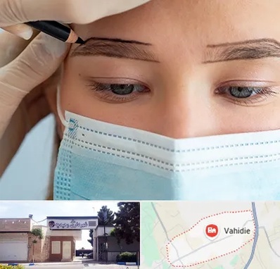 کاشت ابرو در وحیدیه شهریار