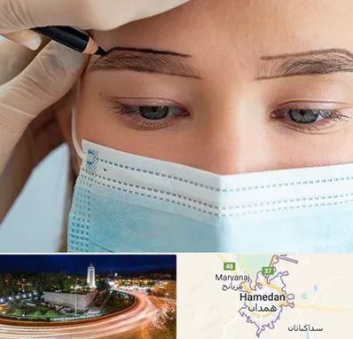 کاشت ابرو در همدان