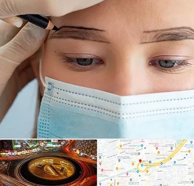 کاشت ابرو در میدان ولیعصر 