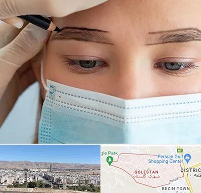 کاشت ابرو در شهرک گلستان شیراز 