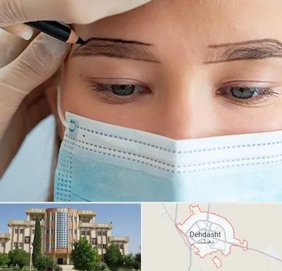 کاشت ابرو در دهدشت