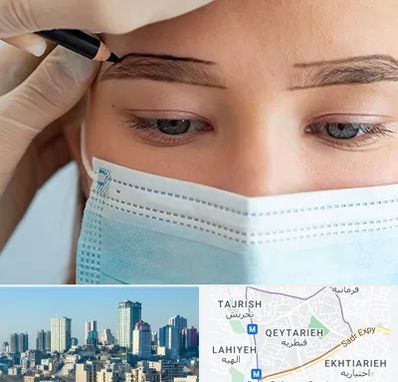 کاشت ابرو در قیطریه 