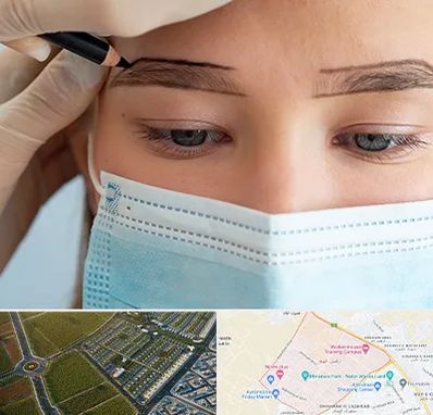 کاشت ابرو در الهیه مشهد 