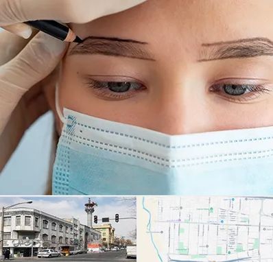 کاشت ابرو در 17شهریور