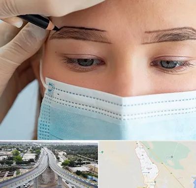 کاشت ابرو در اندیمشک