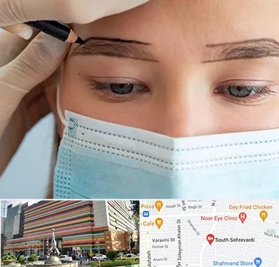 کاشت ابرو در سهروردی 