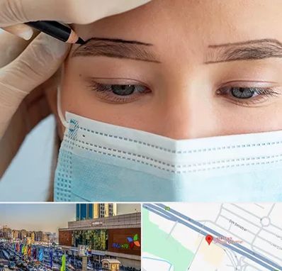 کاشت ابرو در لاله پارک تبریز