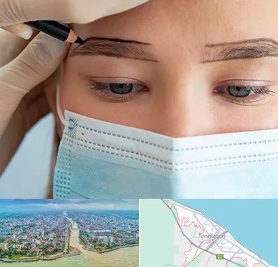 کاشت ابرو در تنکابن