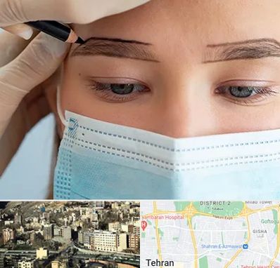 کاشت ابرو در مرزداران 