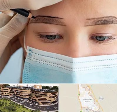 کاشت ابرو در شاهین شهر