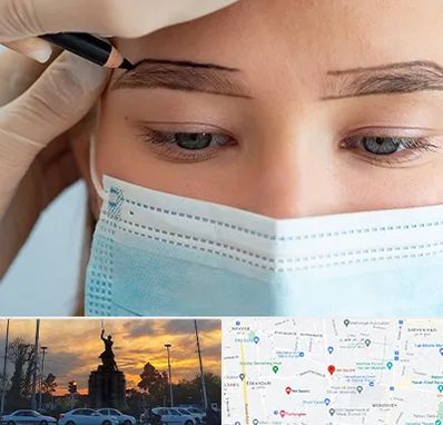 کاشت ابرو در میدان حر 