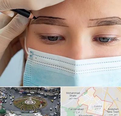 کاشت ابرو در فردیس کرج 