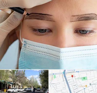 کاشت ابرو در کوی فیروز تبریز