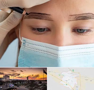 کاشت ابرو در قوچان