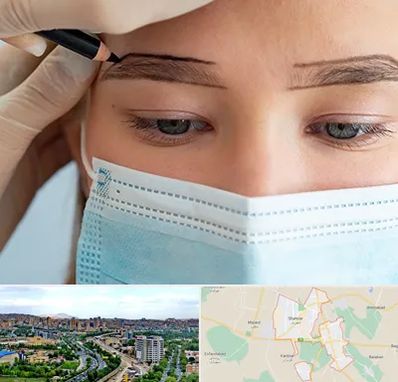 کاشت ابرو در شهریار