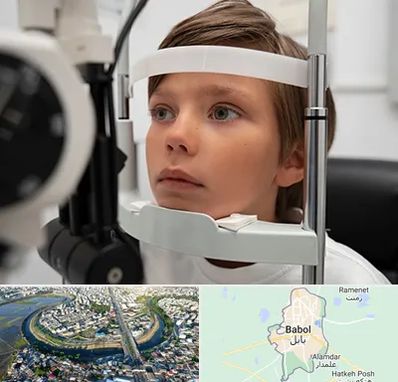 دکتر فوق تخصص شبکیه چشم در بابل