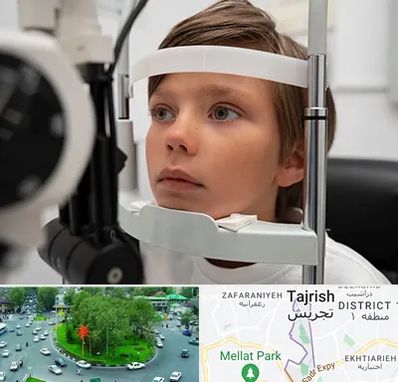 دکتر فوق تخصص شبکیه چشم در تجریش 