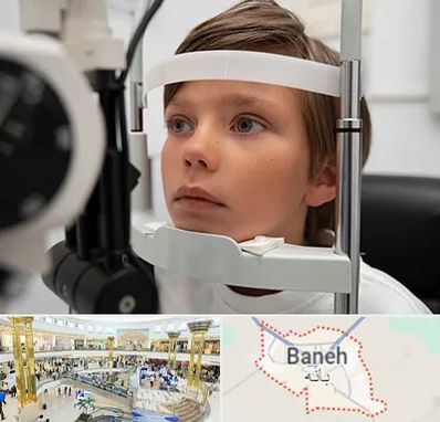 دکتر فوق تخصص شبکیه چشم در بانه