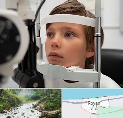 دکتر فوق تخصص شبکیه چشم در رویان