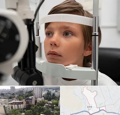 دکتر فوق تخصص شبکیه چشم در اوین