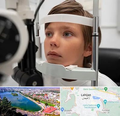 دکتر فوق تخصص شبکیه چشم در لاهیجان