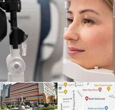 دکتر فوق تخصص چشم در سهروردی 