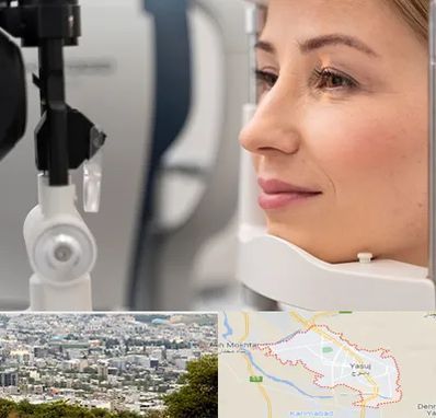 دکتر فوق تخصص چشم در یاسوج