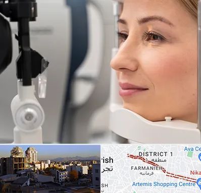 دکتر فوق تخصص چشم در فرمانیه 