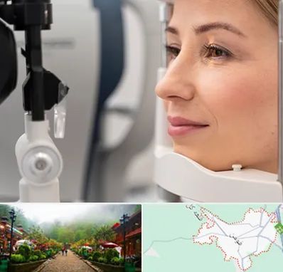 دکتر فوق تخصص چشم در فومن