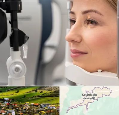 دکتر فوق تخصص چشم در کلاردشت