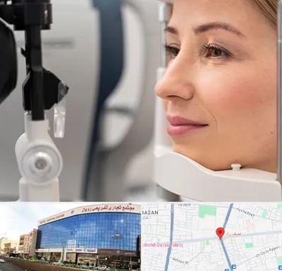 دکتر فوق تخصص چشم در نصف راه تبریز