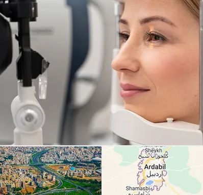 دکتر فوق تخصص چشم در اردبیل