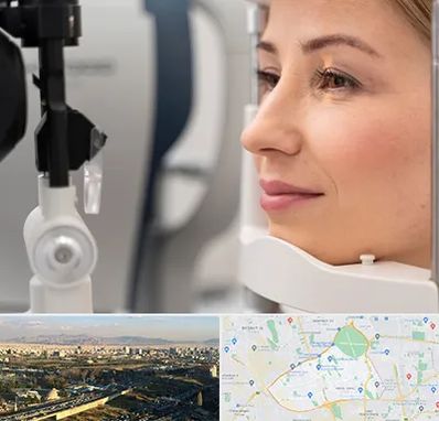 دکتر فوق تخصص چشم در منطقه 19 تهران 