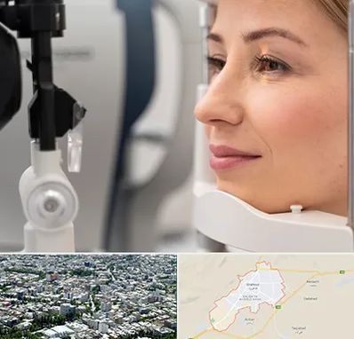 دکتر فوق تخصص چشم در شاهرود