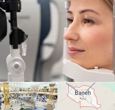 دکتر فوق تخصص چشم در بانه