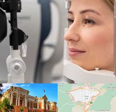 دکتر فوق تخصص چشم در خوی