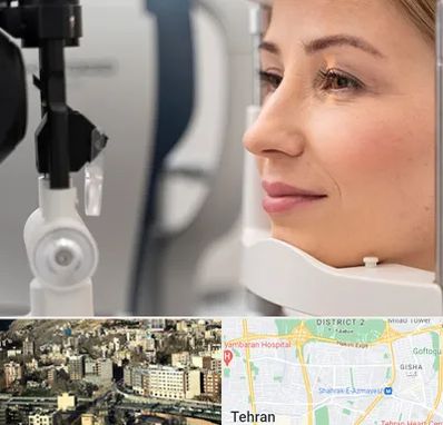 دکتر فوق تخصص چشم در مرزداران 