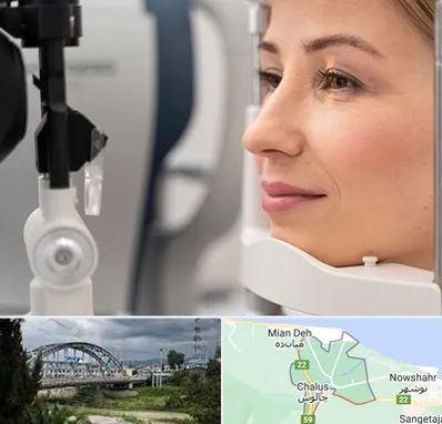 دکتر فوق تخصص چشم در چالوس