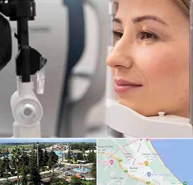 دکتر فوق تخصص چشم در رودسر