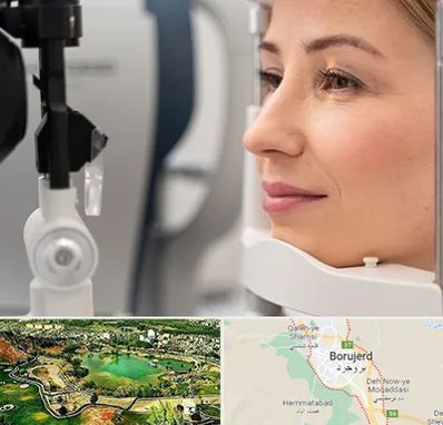 دکتر فوق تخصص چشم در بروجرد