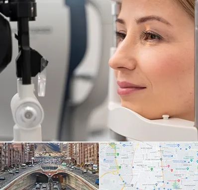 دکتر فوق تخصص چشم در منطقه 10 تهران 